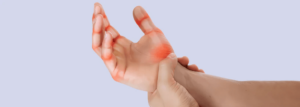 Hand Arthritis Overview